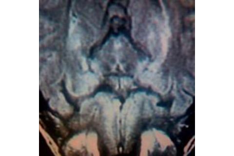 pareidolia_mri_mary.jpg