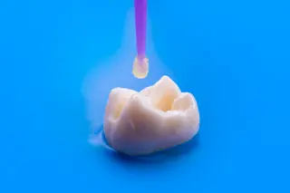 Tooth bonding before filling