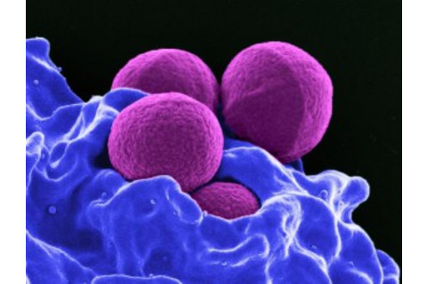microbes-300x227.jpg