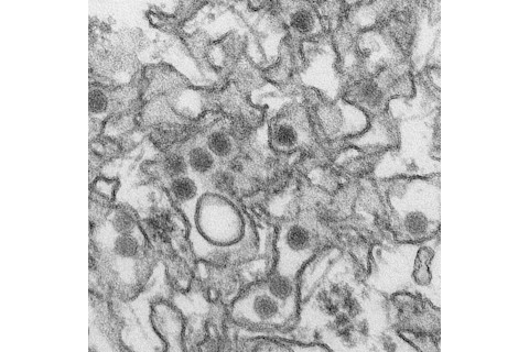 Zika-virus-1024x1024.jpg