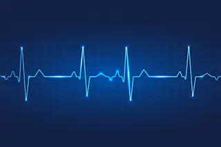 heart-monitor