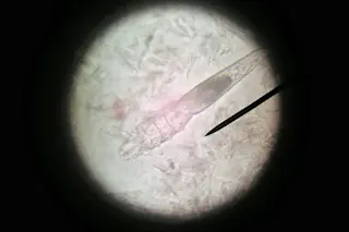 demodex.jpg