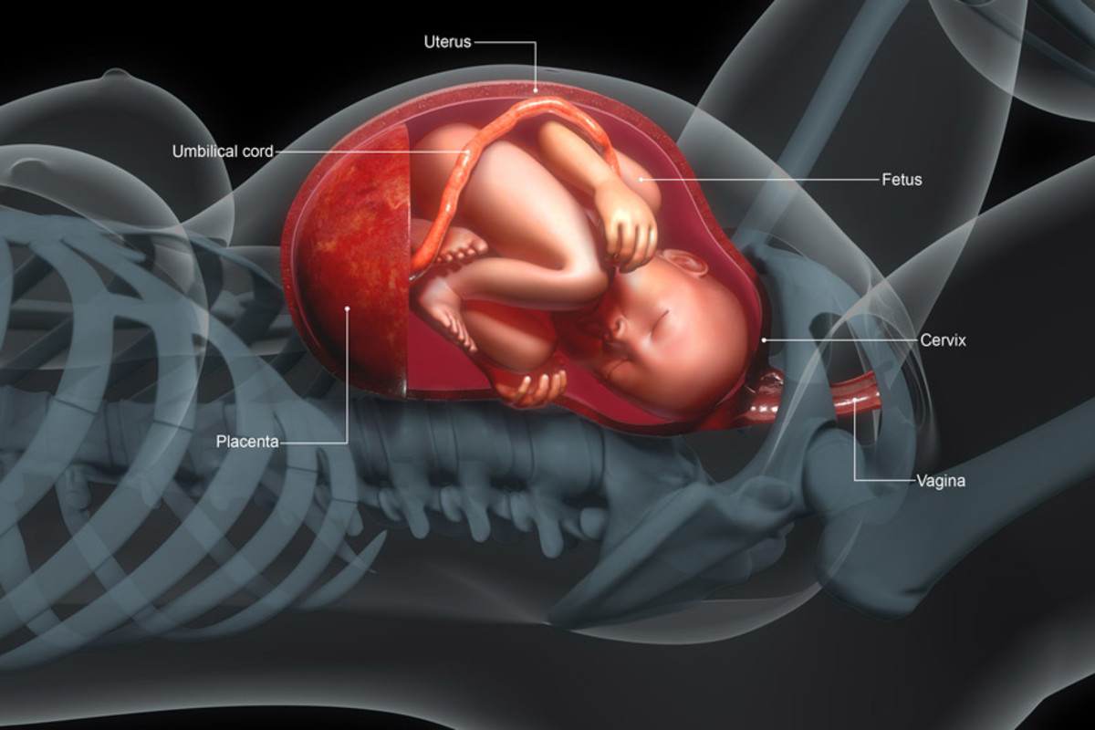 ［入手困難］ PLACENTA／CONDEMNED 🚨 NCLEX Question of the Day 🚨 A 32-year-old pregnant woman at 36