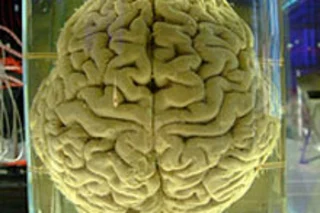 brain220.jpg