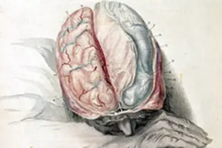 brainweb.jpg