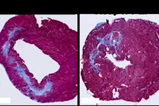 Treated tissue vs untreated tissue