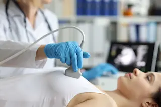 Breast cancer exam