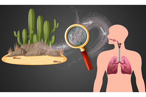 valley fever infection diagram