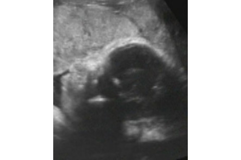 profilePlacenta-251x300.jpg