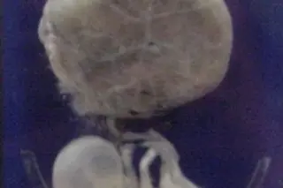 Fetus_3_months-237x300.jpg