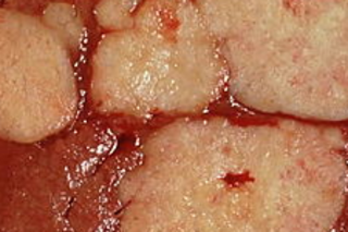 pancreas.png