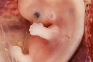 9weekfetus.jpg
