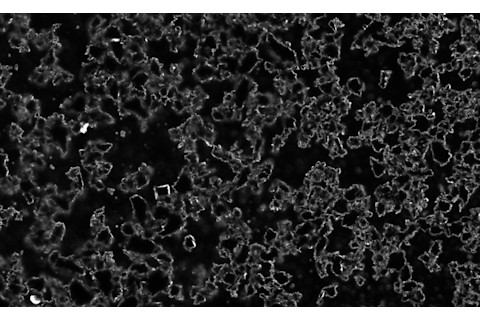 A dark field micrograph of activated charcoal. Notice that each of the tiny pores has an enormous surface area! (Image Credit: Zephyris/Wikimedia Commons)