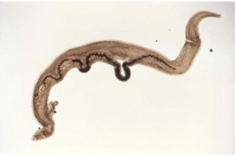 schistosoma mansoni