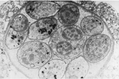toxoplasma gondii