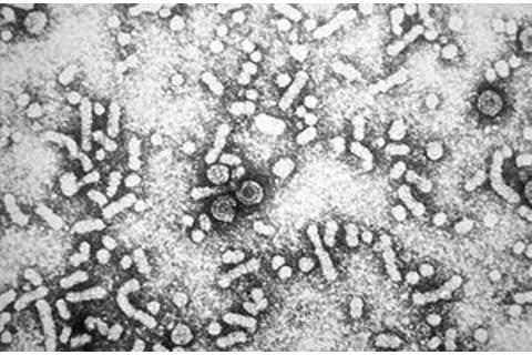 Hepatitis B virus (Credit Wikimedia Commons)