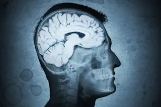 Brain - Shutterstock