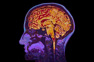 Brain Scan 