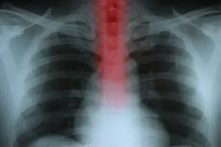 esophagus.jpg