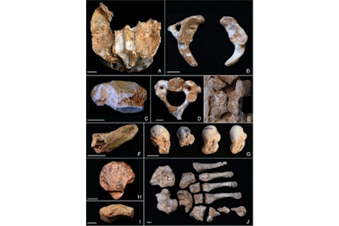 Skeletal abnormalities, El Sidron Neanderthals - Scientific Reports