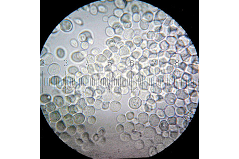 yeast-microscopic.jpg