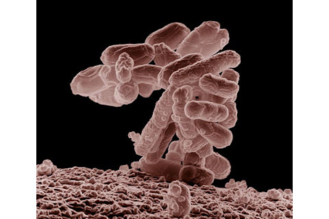 800px-E_coli_at_10000x.jpg