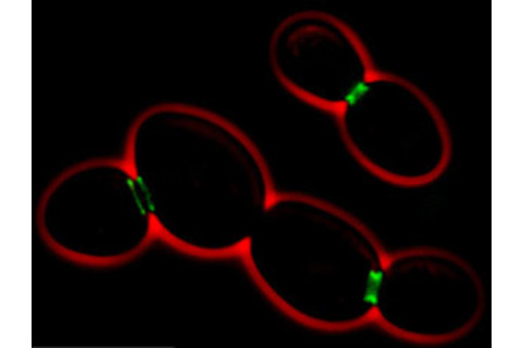 S_cerevisiae_septins.jpg