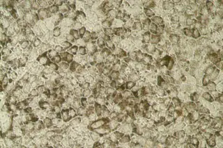 retinal-cells.jpg