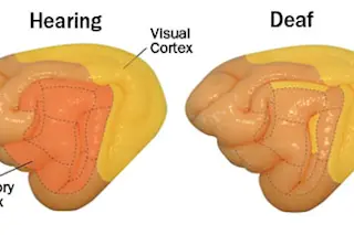 deaf-brain.jpg