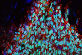 ips-cell-colony.jpg