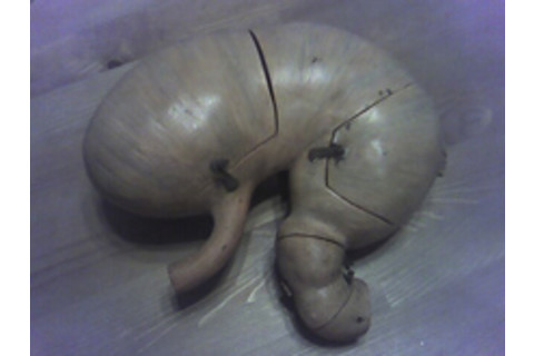 stomach.jpg