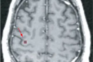 brain159.jpg