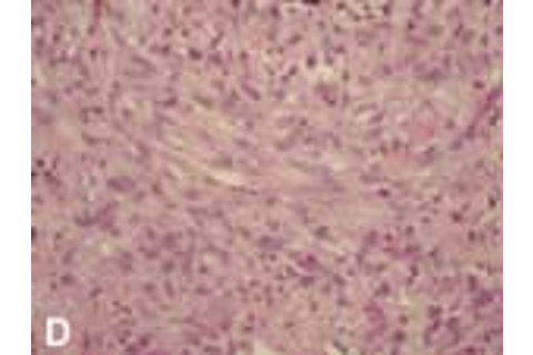 stemcell_d.jpg