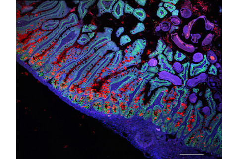 Small Intestine Cells - Broad Institute