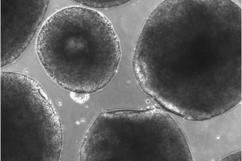 Brain-Organoid-True-Color