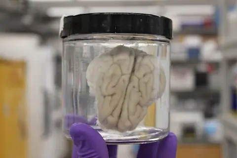 Scientists Brought Brains Brought Back to Life Four Hours After Death ...