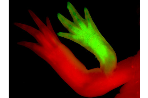 P-limb-from-wound-site 1