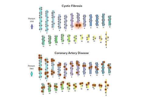 cystic fibrosis heart disease - NIH