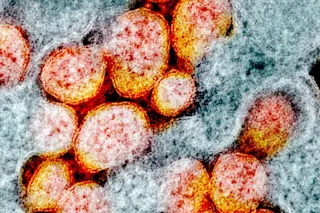 Virus