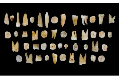 Teeth Found
