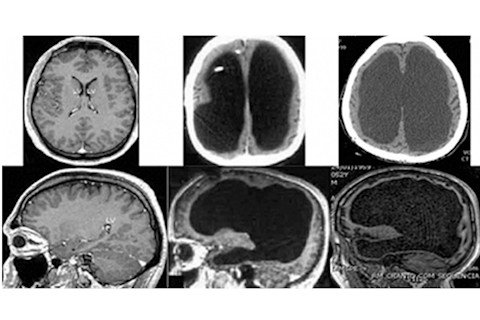 Brains - Forsdyke 2015 Biological Theory