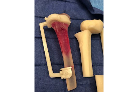 3-d printed bone