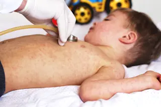 child with a rash doctor measures MIS-C Covid-19 - shutterstock