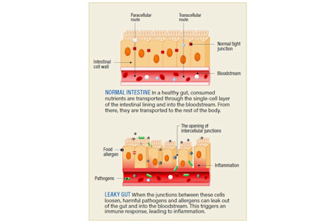 intestinal lining