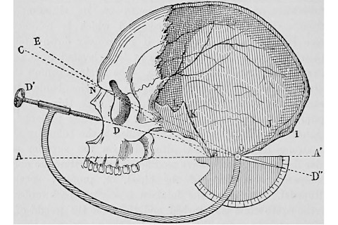 skull measurements anthro - shutterstock
