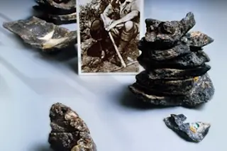 Louis Leakey and fossilized cancerous jaw bone