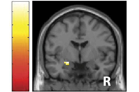 fMRI brain scan smell - Mujica-Parodi et al. 2009 PLoS ONE