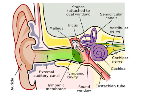 Cochlear Implants 2