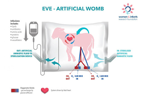 diagram of lamb artificial womb - Credit: Women and Infants Research Foundation
