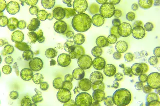 A photomicrograph of a plant protoplast cell isolated for use in a recent cutting-edge biotechnology CRISPR technology experiment.